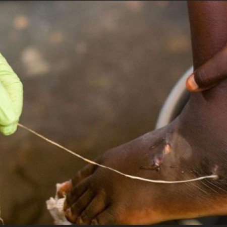 Lutte contre les maladies tropicales négligées (MTN)